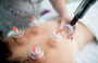 How Cupping Helps Detoxify the Body and Boost Immunity