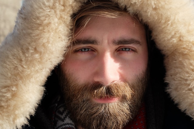 Beard Transplant in Turkey: Why More Men Are Choosing This Life-Changing Procedure