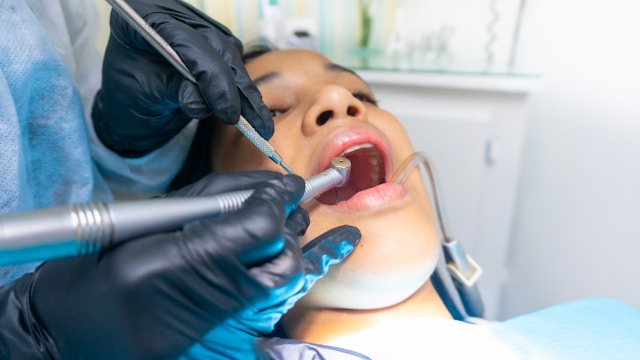 Enhancing Functionality and Aesthetics: The Dual Benefits of Dental Crowns