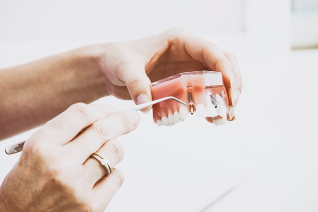 Implants Dentist Nearby Me – Restore Your Smile Confidently